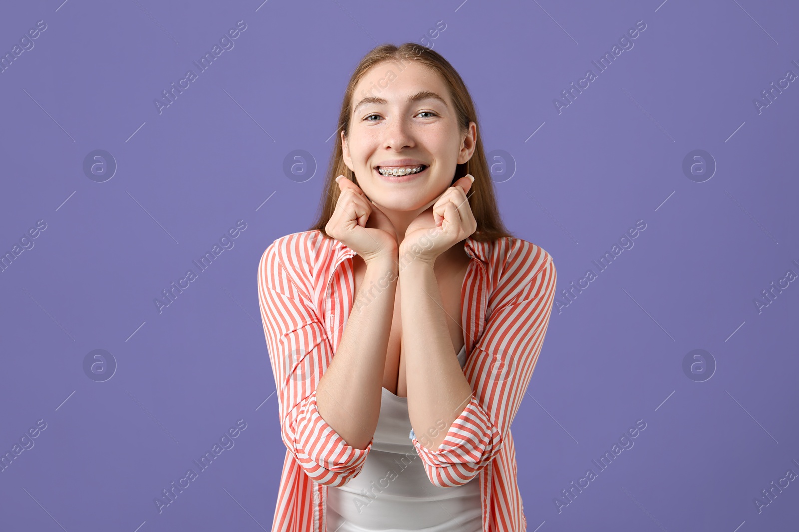 Photo of Smiling girl with braces on purple background