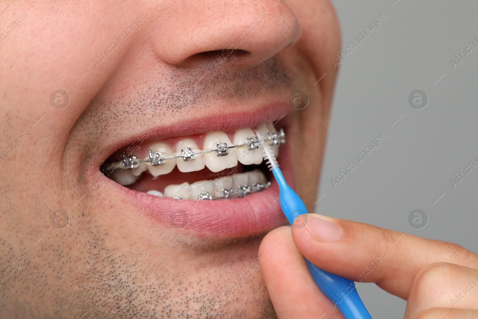 Photo of Man with dental braces cleaning teeth using interdental brush on grey background, closeup