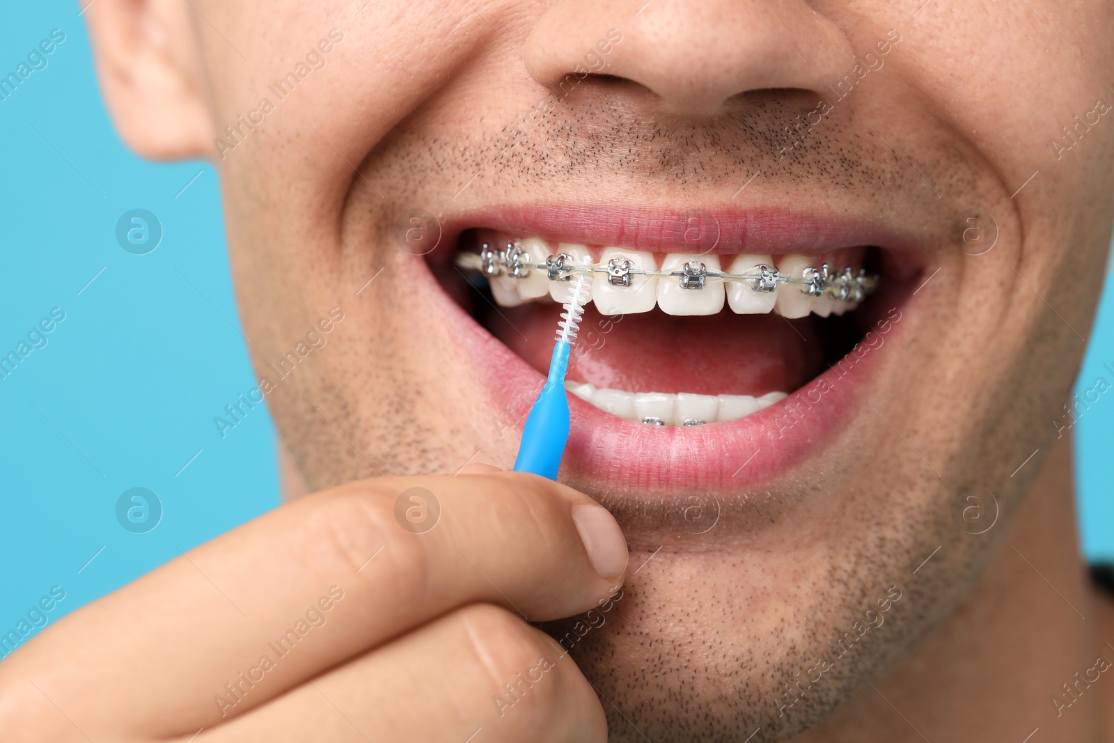 Photo of Man with dental braces cleaning teeth using interdental brush on light blue background, closeup