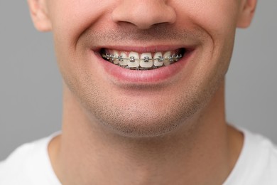 Smiling man with dental braces on grey background, closeup