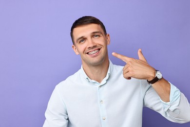 Happy man pointing at his dental braces on violet background