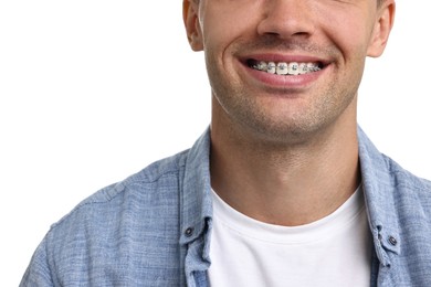 Smiling man with dental braces on white background, closeup