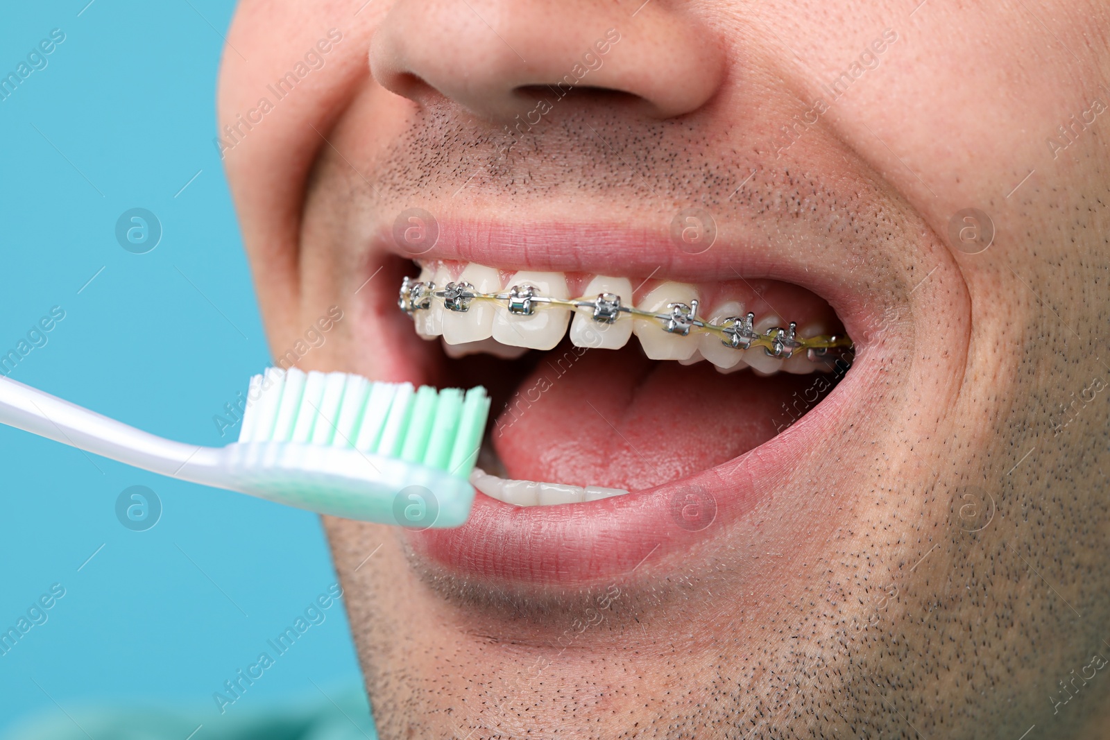 Photo of Man with dental braces cleaning teeth on light blue background, closeup