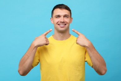 Photo of Smiling man pointing at his dental braces on light blue background