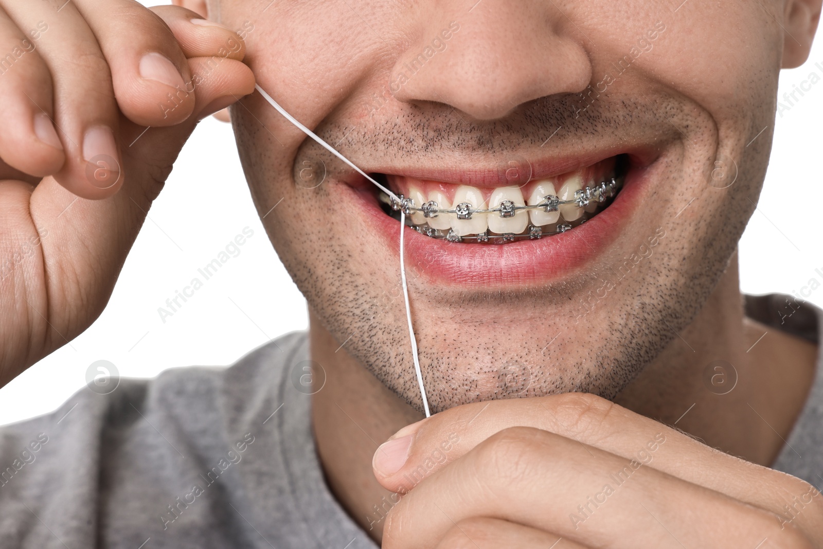 Photo of Man with braces cleaning teeth using dental floss on white background, closeup