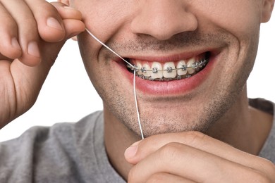 Man with braces cleaning teeth using dental floss on white background, closeup