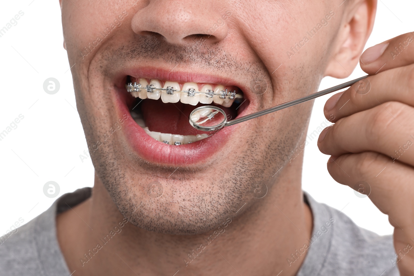 Photo of Examination of man's teeth with braces using mirror tool on white background, closeup