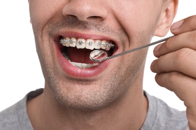 Examination of man's teeth with braces using mirror tool on white background, closeup