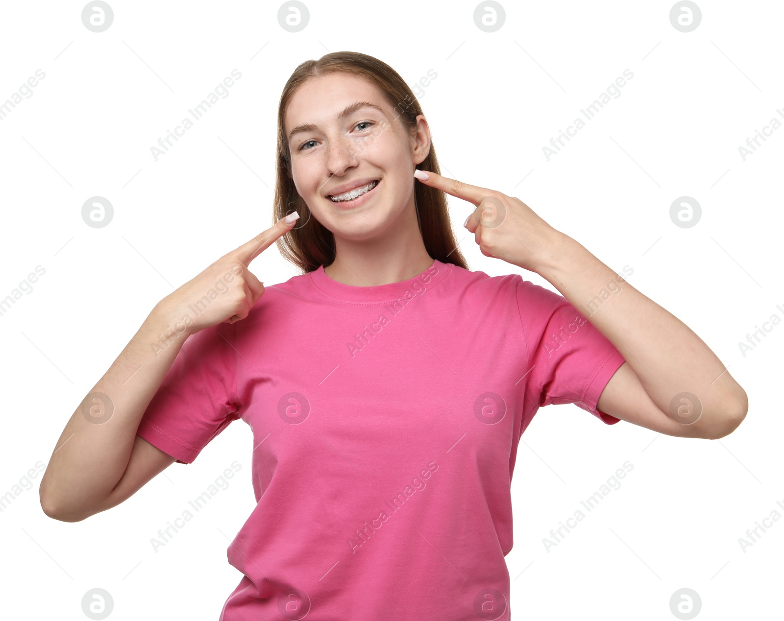 Photo of Smiling girl pointing at her braces on white background