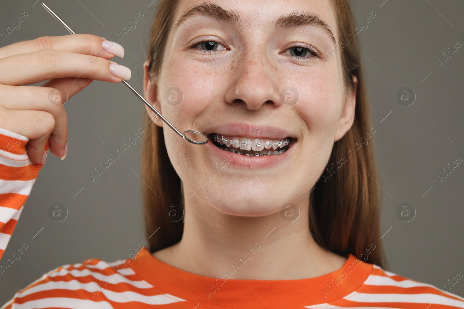 Photo of Smiling girl with braces using dental mirror on grey background