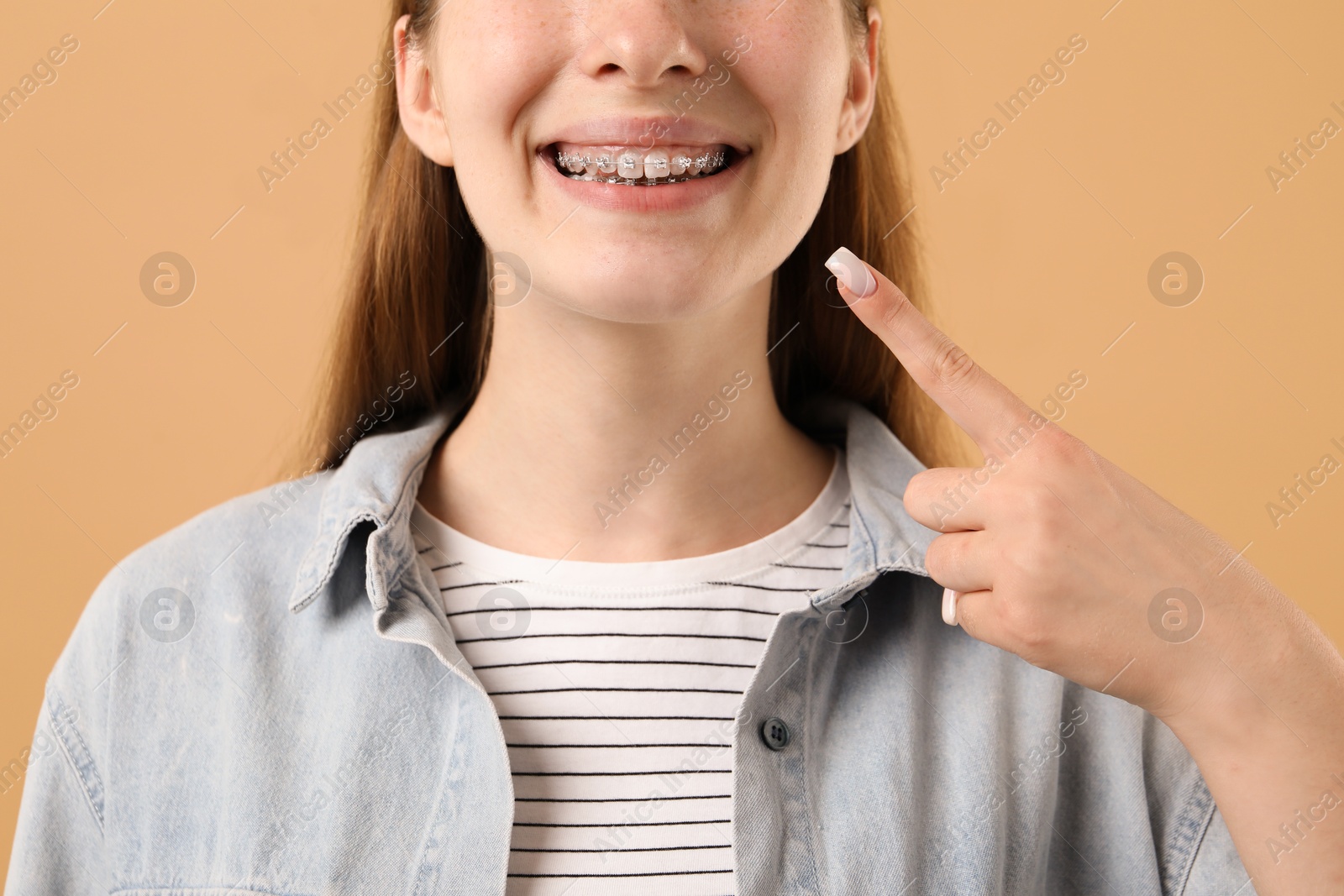 Photo of Girl pointing at her braces on beige background, closeup