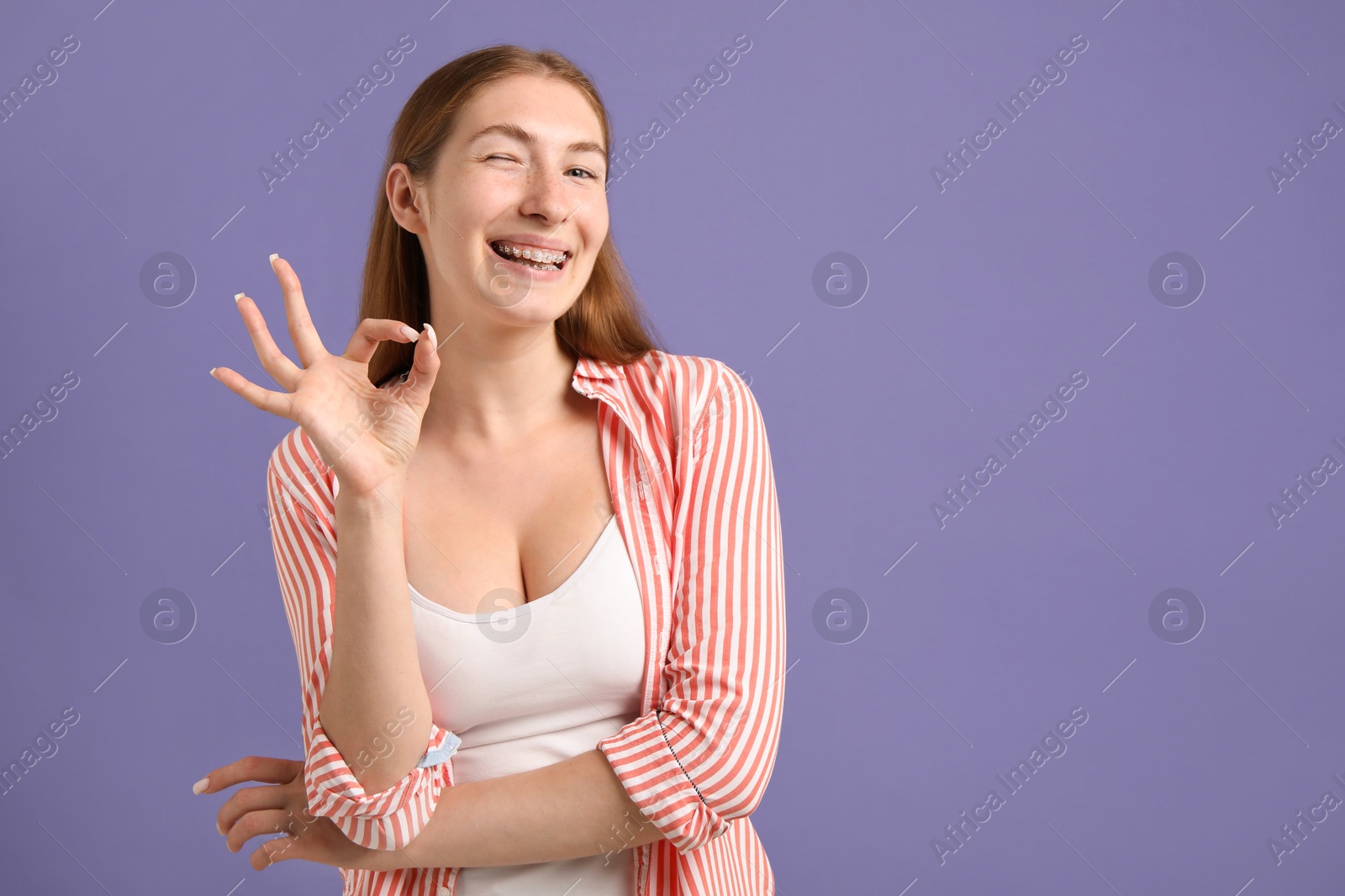 Photo of Smiling girl with braces showing ok gesture on purple background, space for text