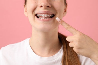 Photo of Girl pointing at her braces on pink background, closeup