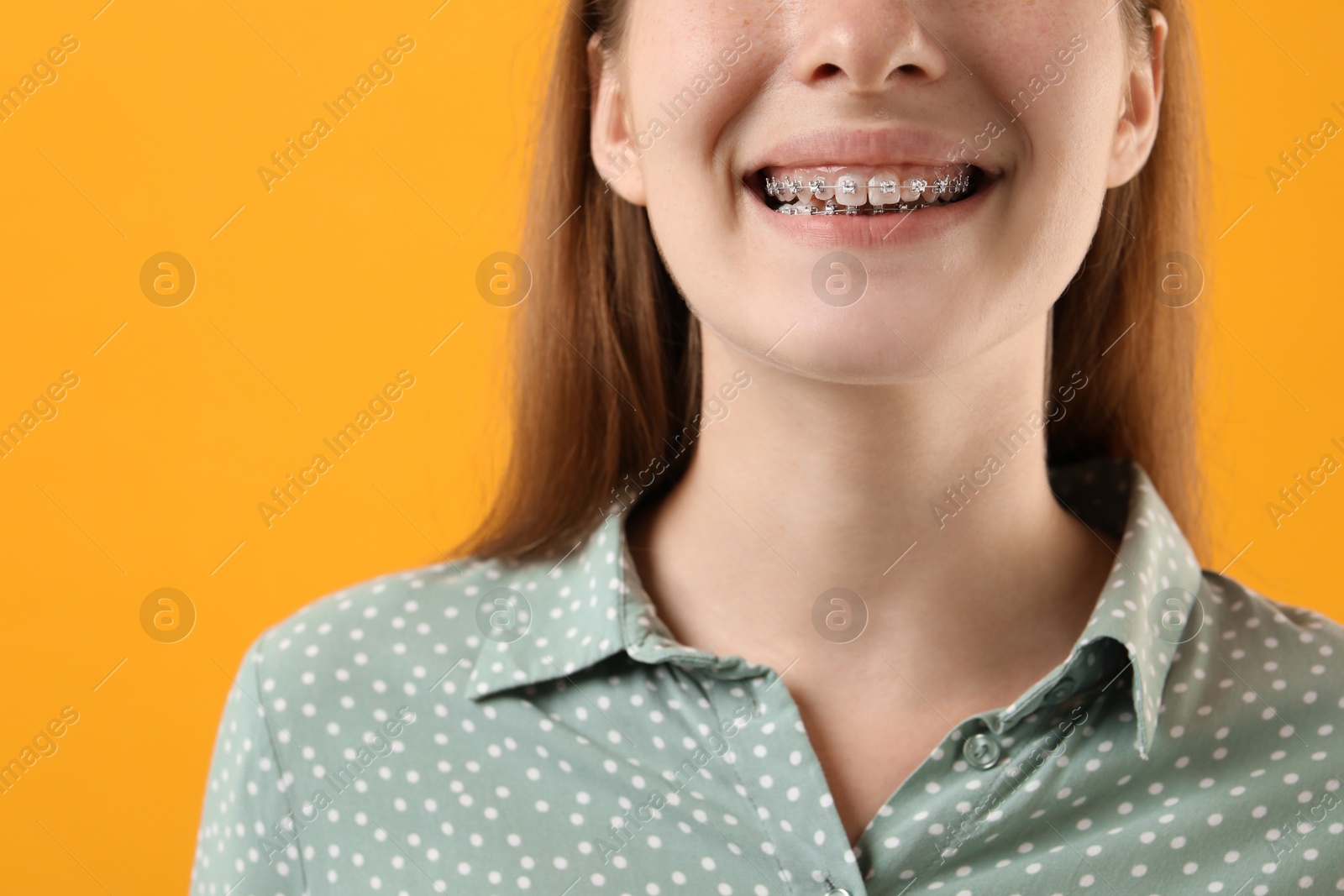 Photo of Girl with braces on orange background, closeup