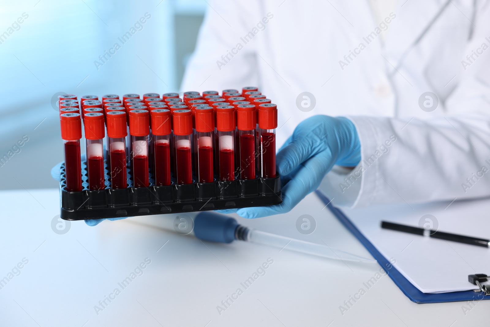 Photo of Laboratory testing. Doctor with blood samples at table indoors, closeup