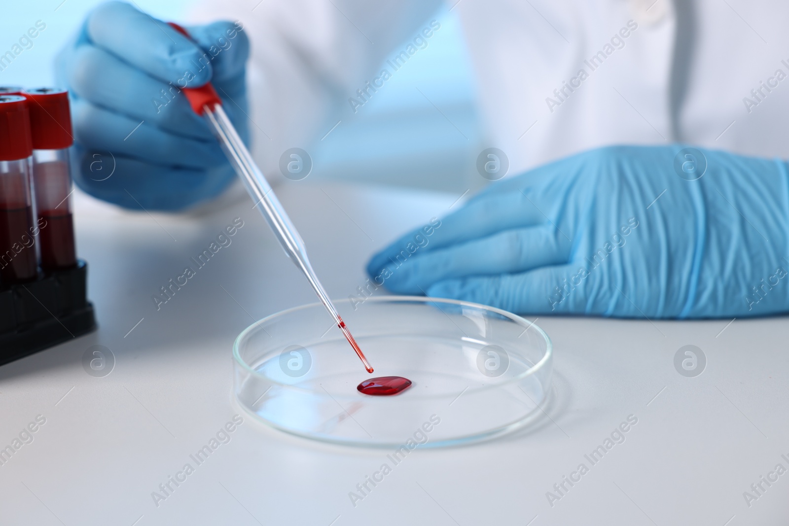 Photo of Laboratory testing. Doctor dripping blood sample into Petri dish at table indoors, closeup