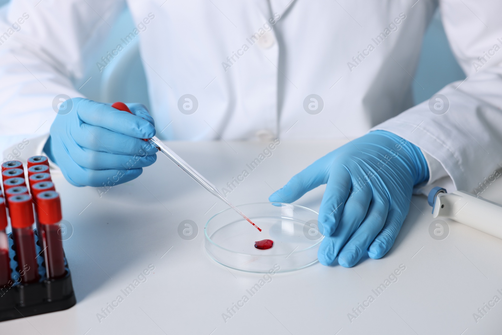 Photo of Laboratory testing. Doctor dripping blood sample into Petri dish at table indoors, closeup