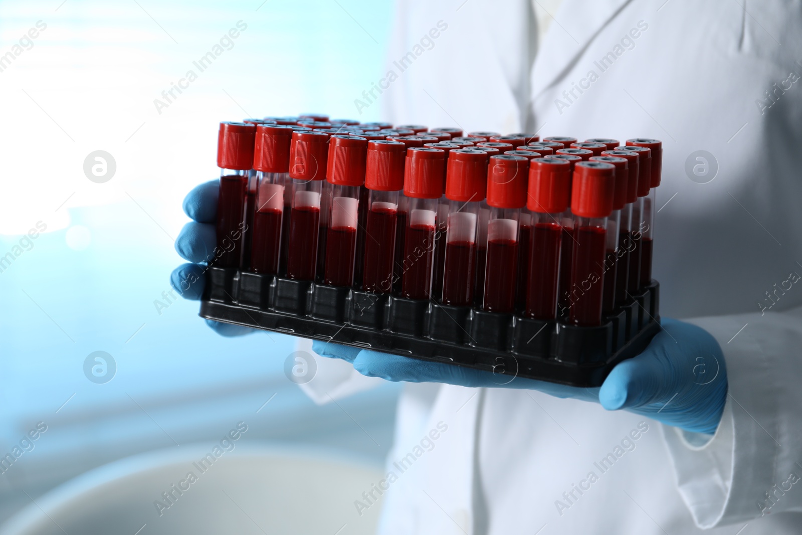 Photo of Laboratory testing. Doctor with blood samples indoors, closeup