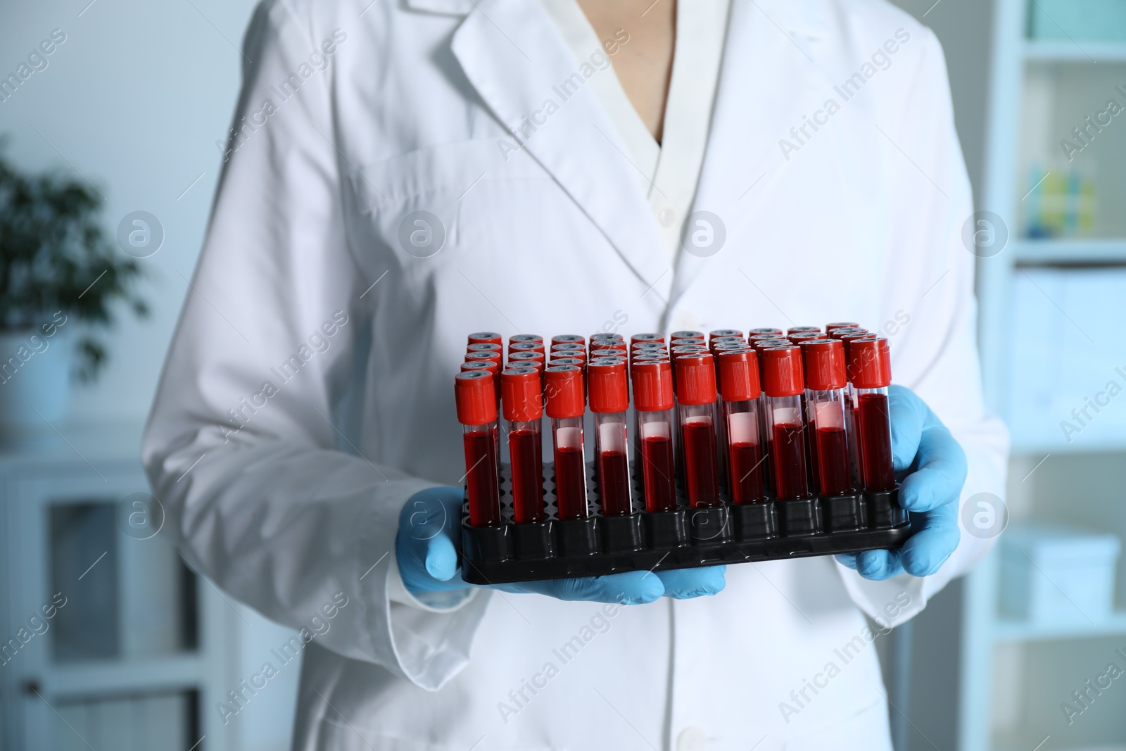 Photo of Laboratory testing. Doctor with blood samples indoors, closeup