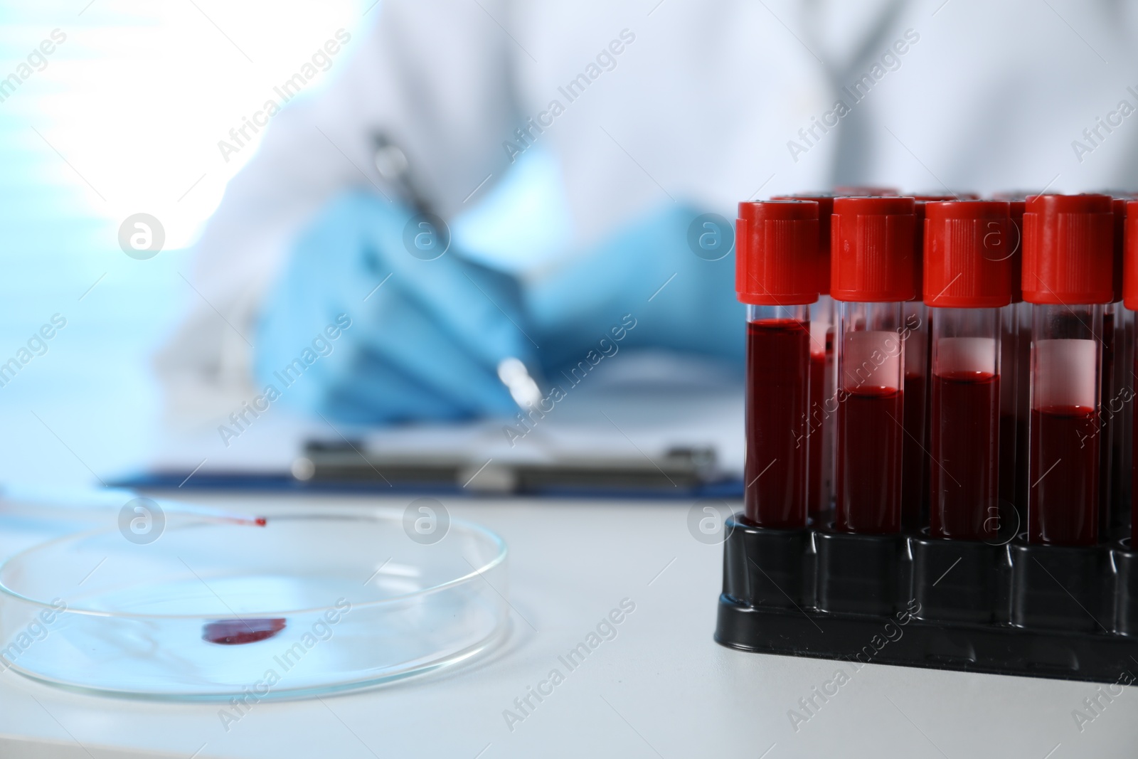 Photo of Laboratory testing. Doctor working at table indoors, focus on blood samples