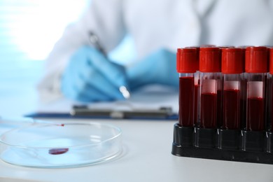 Photo of Laboratory testing. Doctor working at table indoors, focus on blood samples