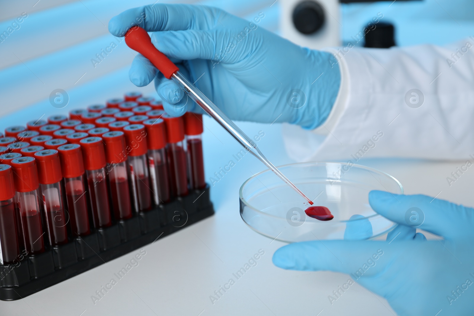 Photo of Laboratory testing. Doctor dripping blood sample into Petri dish at table indoors, closeup