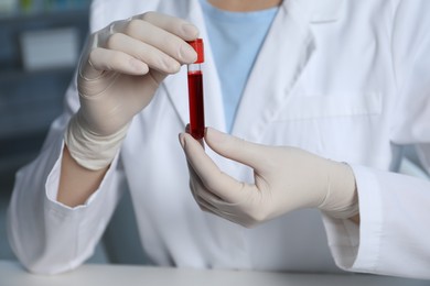 Laboratory testing. Doctor holding test tube with blood sample indoors, closeup