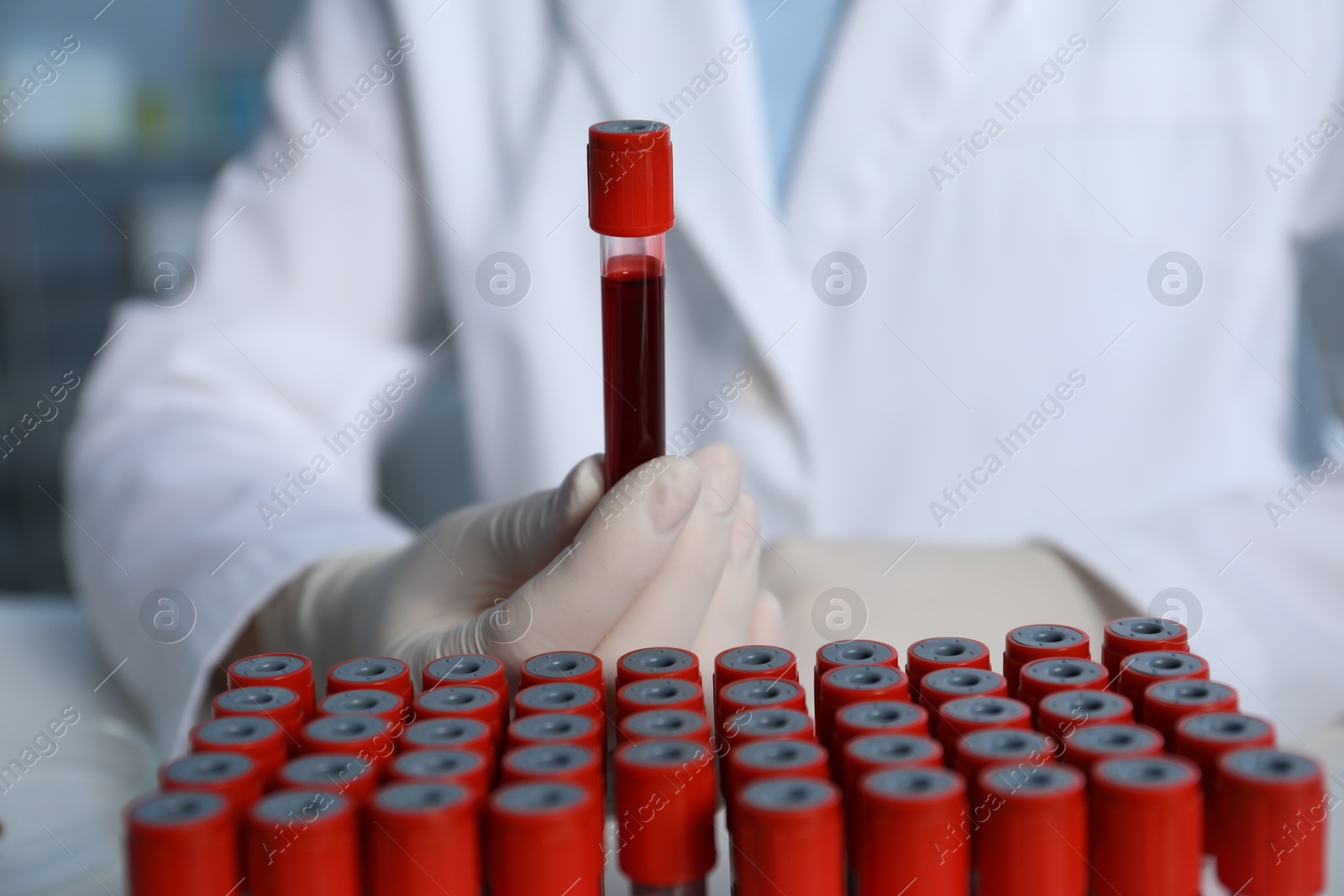 Photo of Laboratory testing. Doctor holding test tube with blood sample indoors, closeup