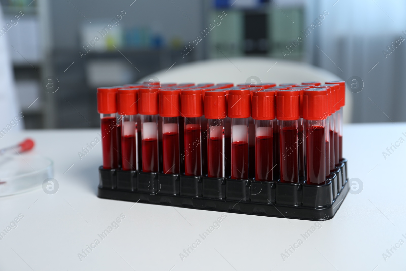 Photo of Laboratory testing. Test tubes with blood samples on white table indoors