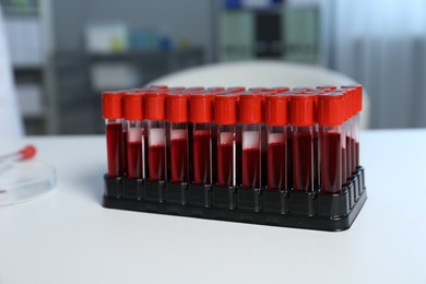 Laboratory testing. Test tubes with blood samples on white table indoors