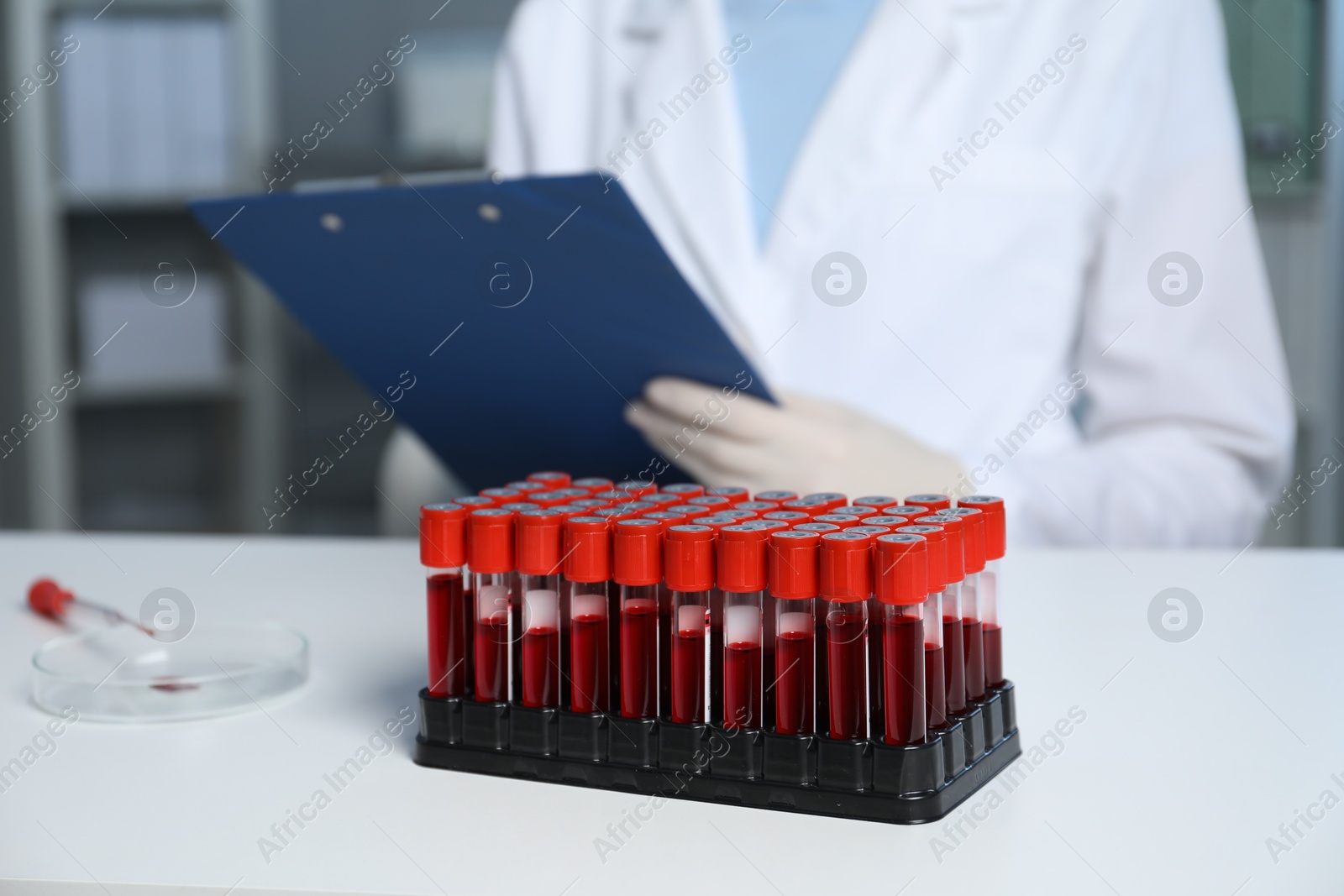 Photo of Laboratory testing. Doctor working at table indoors, focus on blood samples