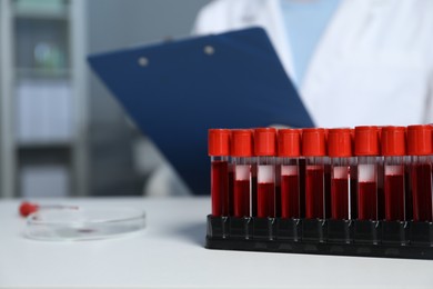 Photo of Laboratory testing. Doctor working at table indoors, focus on blood samples