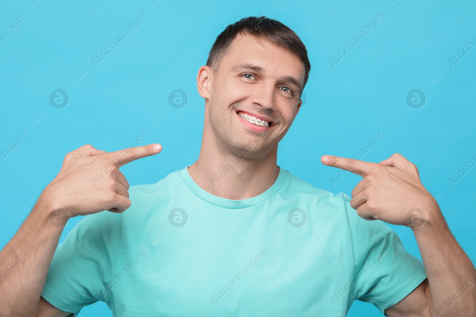 Photo of Smiling man pointing at his dental braces on light blue background