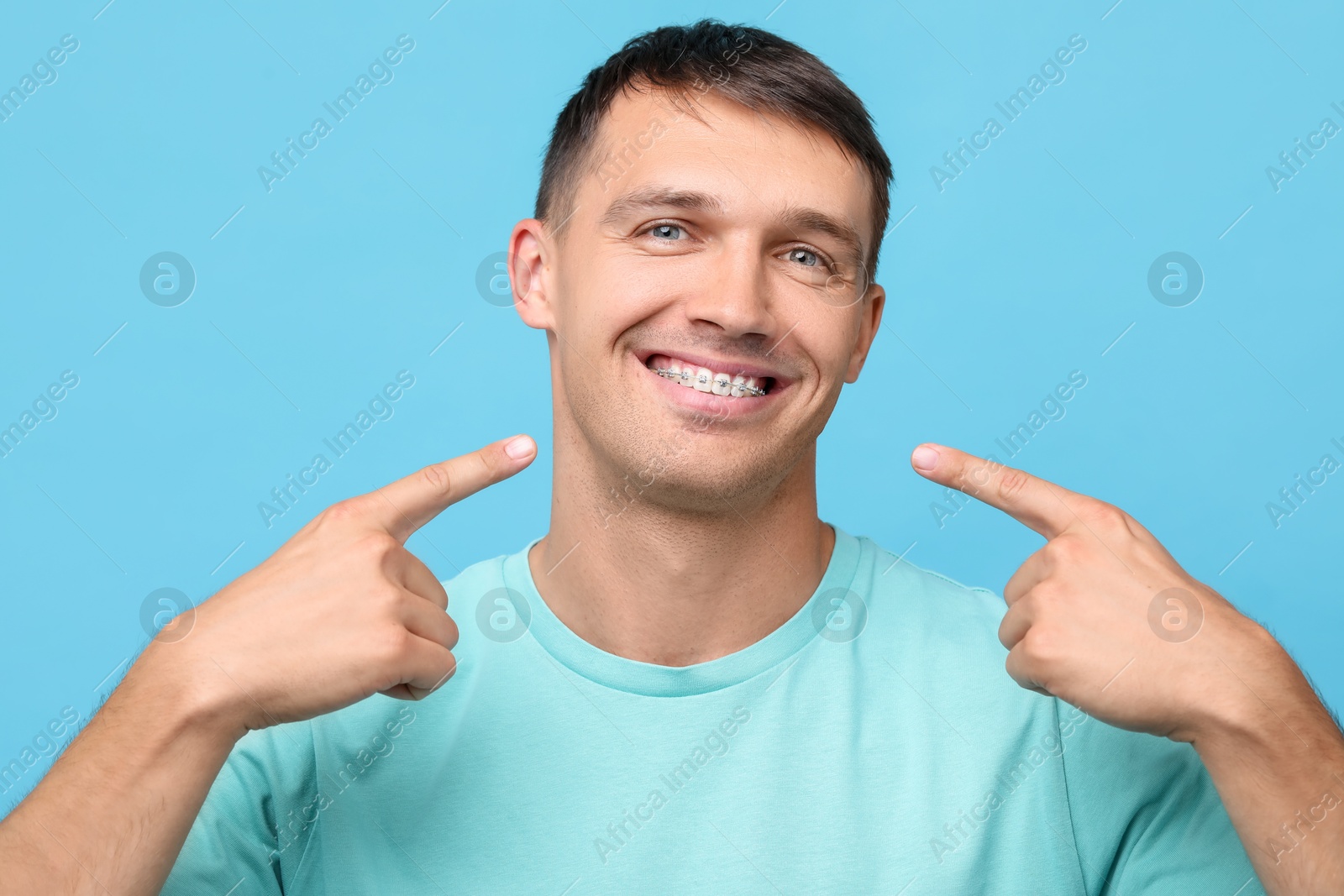 Photo of Smiling man pointing at his dental braces on light blue background