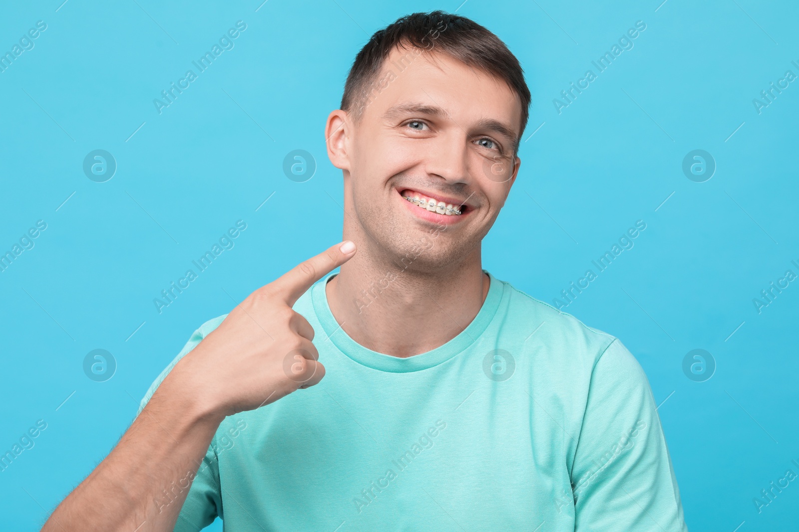 Photo of Smiling man pointing at his dental braces on light blue background