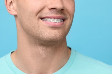 Man with dental braces on light blue background, closeup