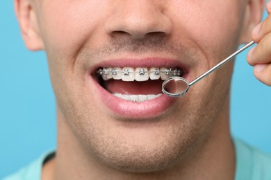 Examination of man's teeth with braces using mirror tool on light blue background, closeup