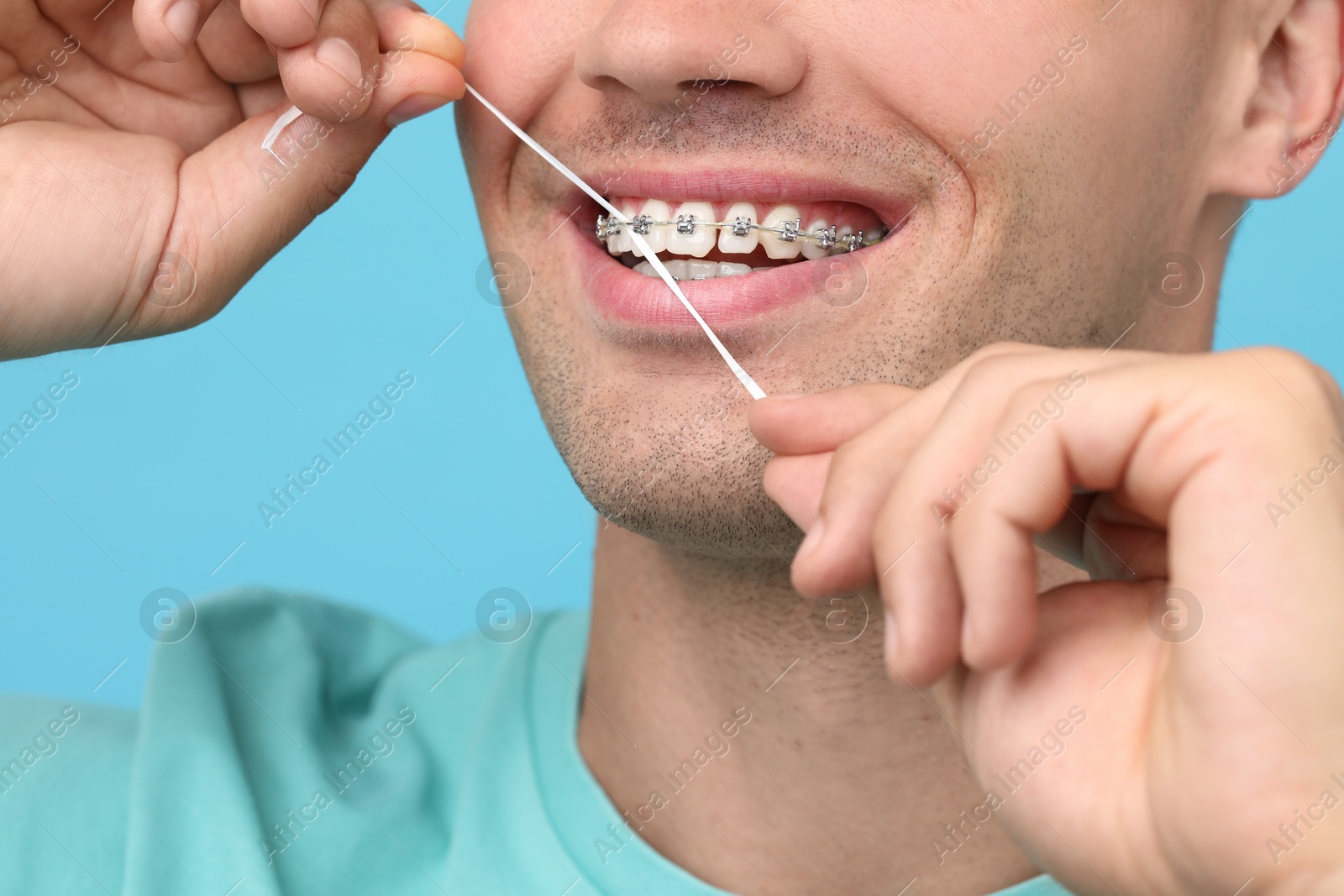 Photo of Man with braces cleaning teeth using dental floss on light blue background, closeup