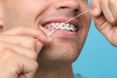 Man with braces cleaning teeth using dental floss on light blue background, closeup