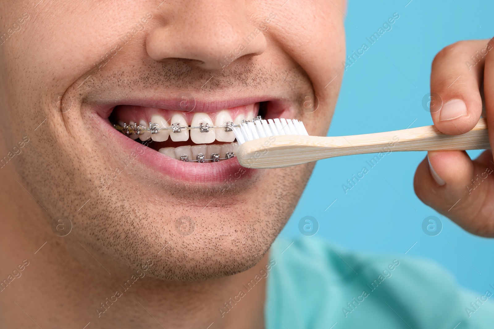 Photo of Man with dental braces cleaning teeth on light blue background, closeup