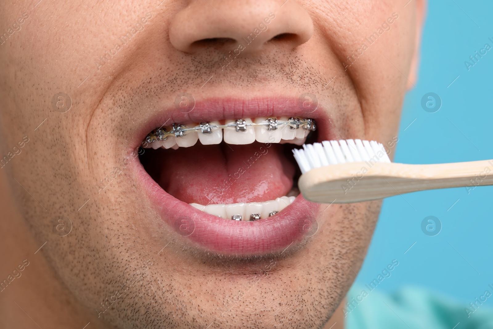 Photo of Man with dental braces cleaning teeth on light blue background, closeup