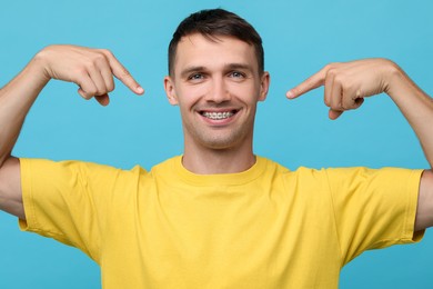 Smiling man pointing at his dental braces on light blue background