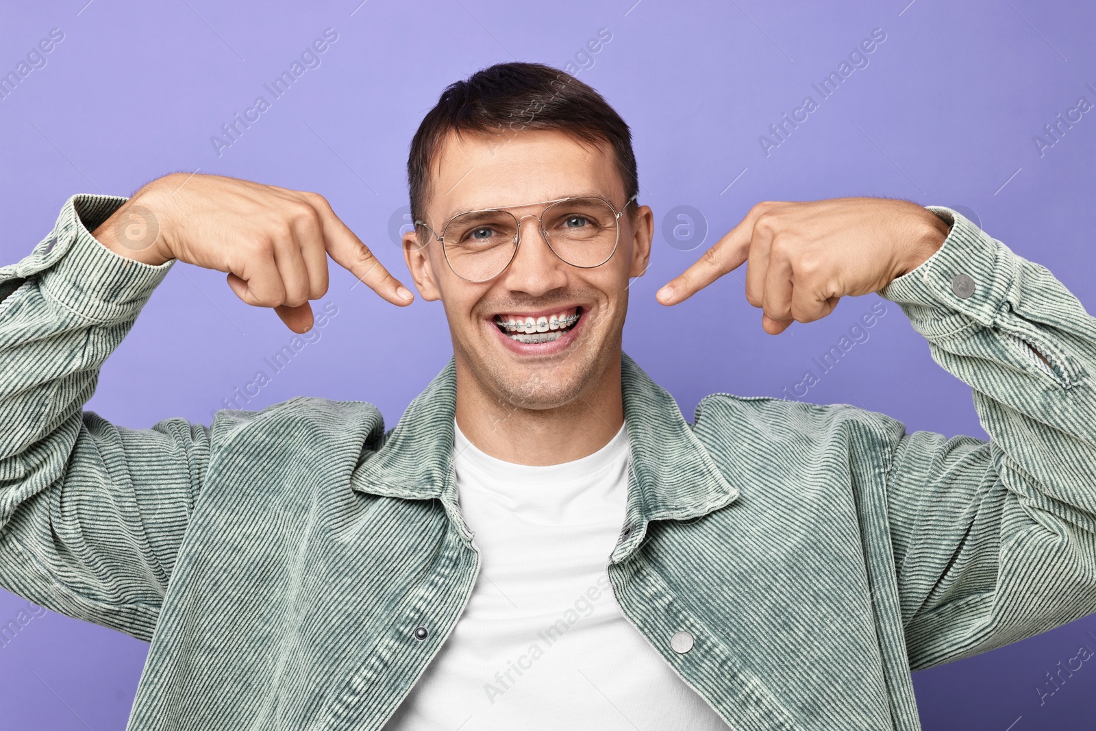 Photo of Happy man pointing at his dental braces on violet background