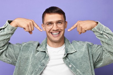 Happy man pointing at his dental braces on violet background