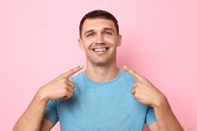 Happy man pointing at his dental braces on pink background