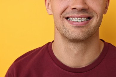 Smiling man with dental braces on yellow background, closeup