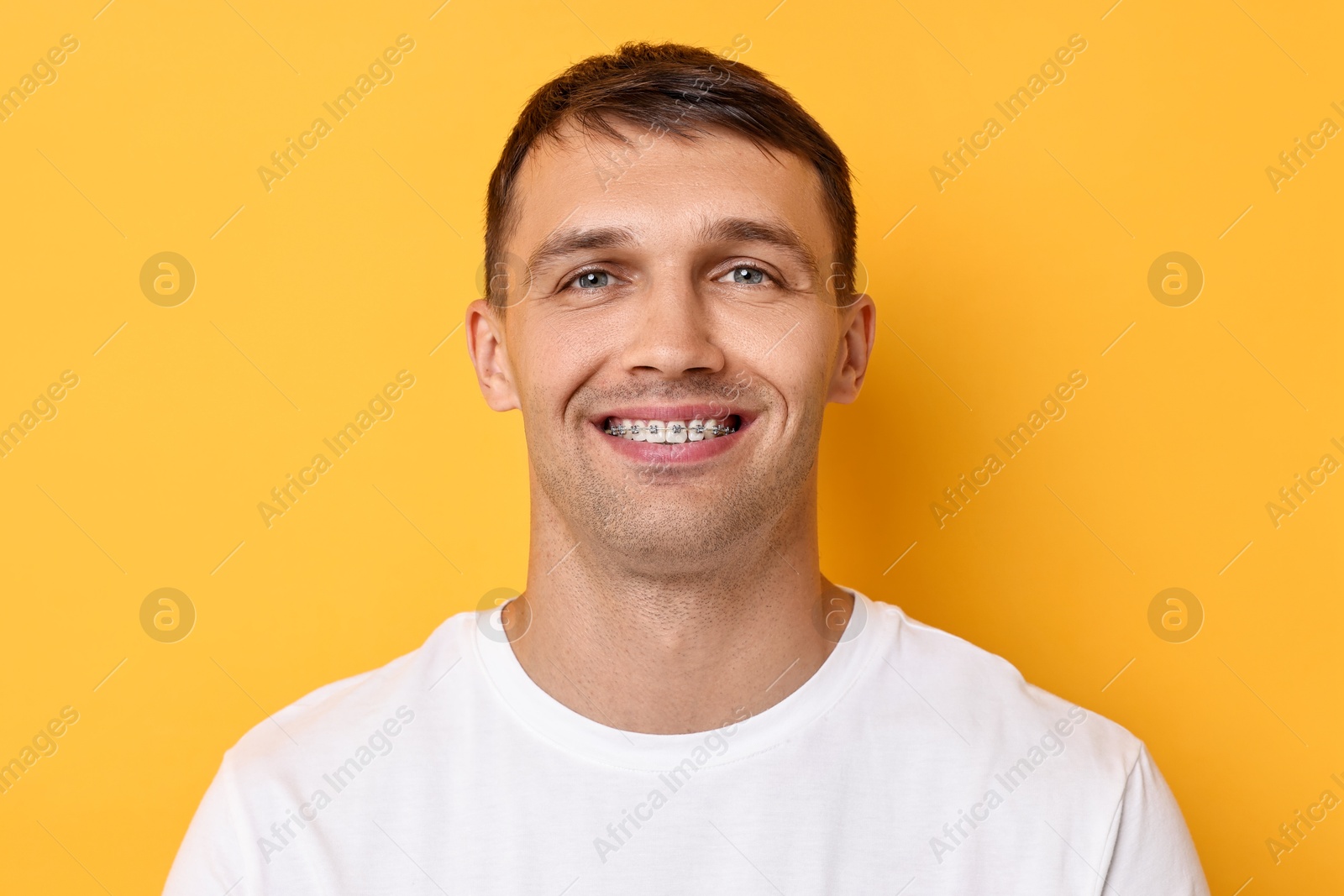 Photo of Smiling man with dental braces on yellow background