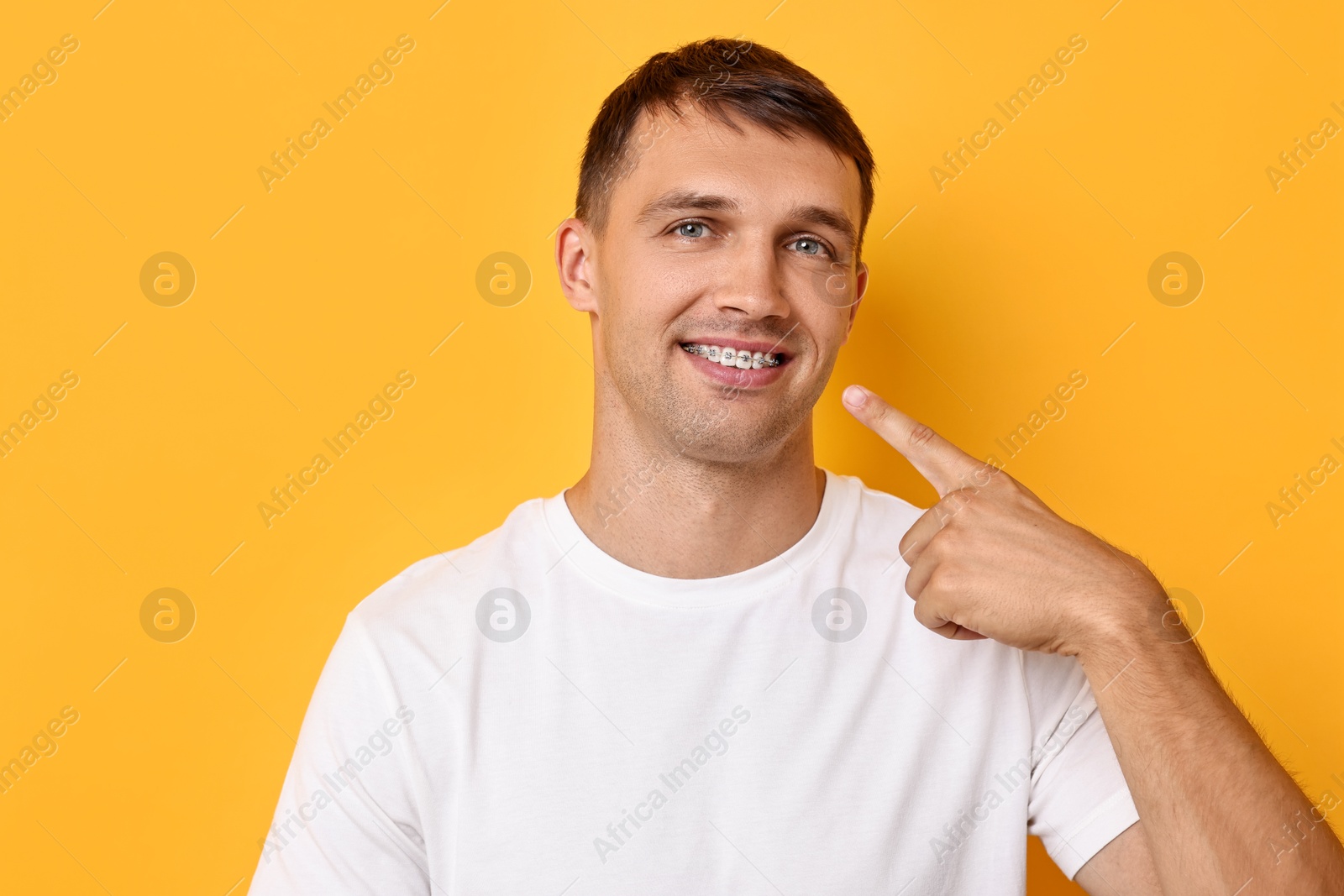 Photo of Smiling man pointing at his dental braces on yellow background