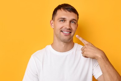 Smiling man pointing at his dental braces on yellow background