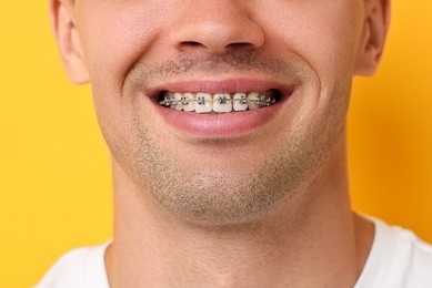 Smiling man with dental braces on yellow background, closeup